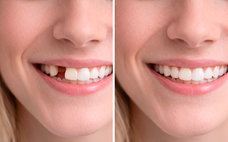 Vista de servicios dentales 4