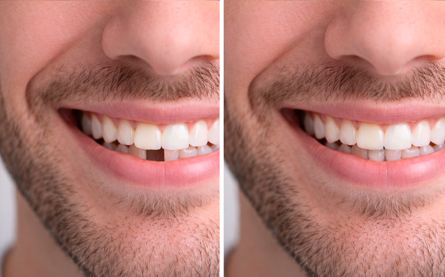 Vista de servicios dentales 5